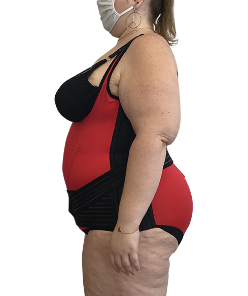 Ceinture obésité CMA